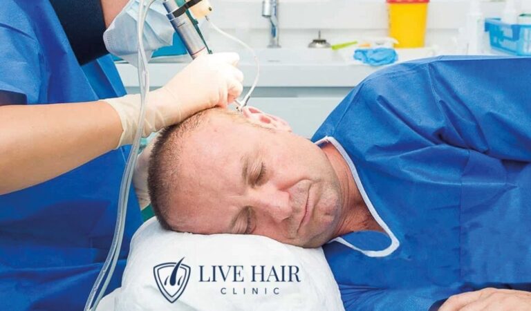 Saç ekimi, İstanbul saç ekimi, Saç ekimi fiyatları